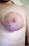 Onlyfans Leaked Photos - Rozehips - Photos