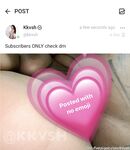 Onlyfans Leaked Photos - Kkvshfeet - Photos