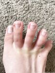 Onlyfans Leaked Photos - Qxeenkay.Feetts - Photos