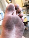 Onlyfans Leaked Photos - Feet-From-J - Photos