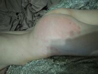 Amateur - Devki Uno 37444 Vozbuzhdennaja Lisichka Ljubit Hlopki Po Popke - Devki Popke 37444 Po Vozbuzhdennaja Uno Lisichka Ljubit Hlopki Erotic